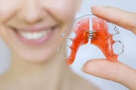 Apparecchio mobile per bambino